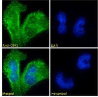 Immunocytochemistry/ Immunofluorescence: CBR1 Antibody [NB100-1066]