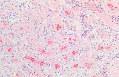 Immunohistochemistry-Paraffin: CBR1 Antibody [NB100-1066]