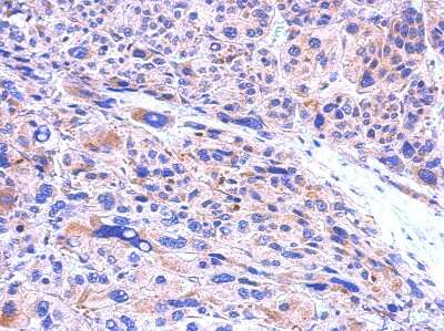 Immunohistochemistry-Paraffin: CBR1 Antibody [NBP1-30942]