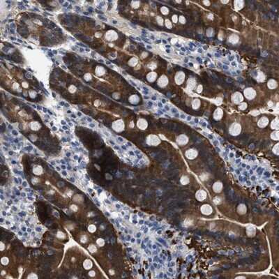 Immunohistochemistry-Paraffin: CBR1 Antibody [NBP1-86595]