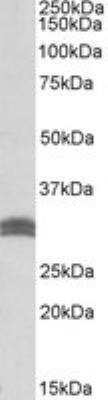 Western Blot: CBR1 Antibody [NB100-1066]