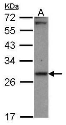 Western Blot: CBR1 Antibody [NBP1-30942]