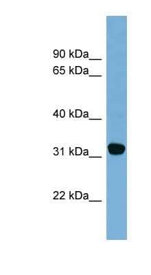 Western Blot: CBR1 Antibody [NBP1-52871]