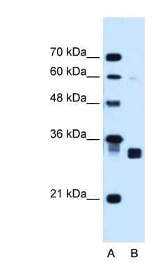 Western Blot: CBR1 Antibody [NBP1-52872]