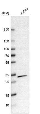 Western Blot: CBR1 Antibody [NBP1-86595]