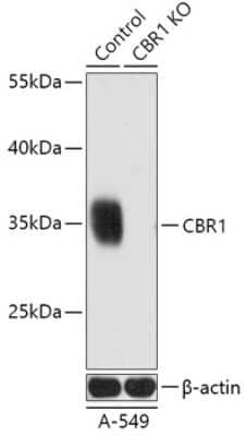 Western Blot: CBR1 AntibodyAzide and BSA Free [NBP3-03418]