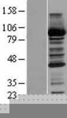 Western Blot: CBR1 Overexpression Lysate [NBP2-04206]