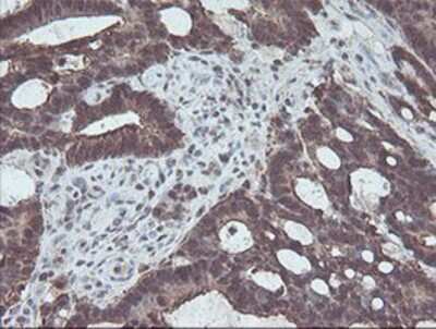 Immunohistochemistry-Paraffin: CBR3 Antibody (OTI1G6) [NBP2-00997]