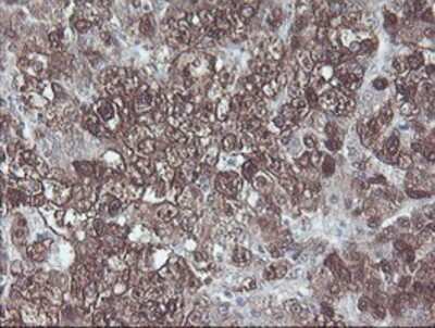 Immunohistochemistry-Paraffin: CBR3 Antibody (OTI1G6) [NBP2-00997]