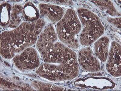 Immunohistochemistry-Paraffin: CBR3 Antibody (OTI1G6) [NBP2-00997]