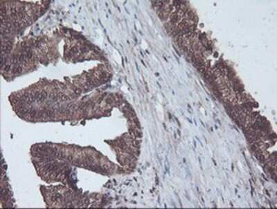 Immunohistochemistry-Paraffin: CBR3 Antibody (OTI1G6) [NBP2-00997]