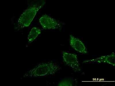 Immunocytochemistry/ Immunofluorescence: CBR3 Antibody (1G8) [H00000874-M05]