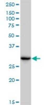 Western Blot: CBR3 Antibody (1G8) [H00000874-M05]