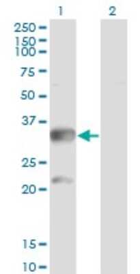 Western Blot: CBR3 Antibody (1G8) [H00000874-M05]