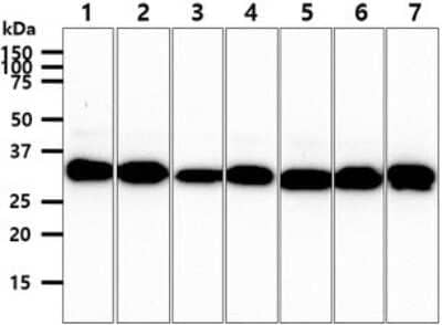 Western Blot: CBR3 Antibody (7E8)BSA Free [NBP2-59401]