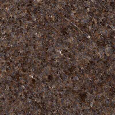 Immunohistochemistry-Paraffin: CBR3 Antibody [NBP1-87065]