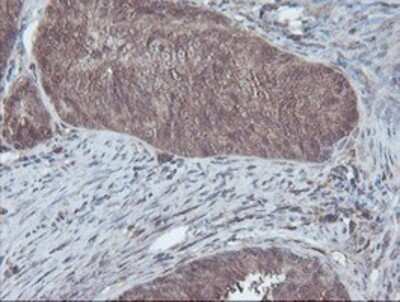 Immunohistochemistry: CBR3 Antibody (OTI1G6) - Azide and BSA Free [NBP2-70343]