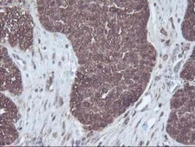 Immunohistochemistry: CBR3 Antibody (OTI1G6) - Azide and BSA Free [NBP2-70343]