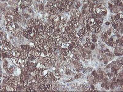 Immunohistochemistry: CBR3 Antibody (OTI1G6) - Azide and BSA Free [NBP2-70343]