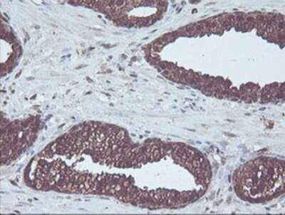 Immunohistochemistry: CBR3 Antibody (OTI1G6) - Azide and BSA Free [NBP2-70343]