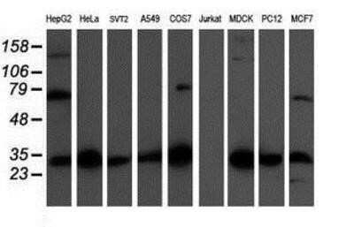 Western Blot: CBR3 Antibody (OTI1G6)Azide and BSA Free [NBP2-70343]