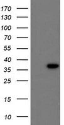 Western Blot: CBR3 Antibody (OTI1G6)Azide and BSA Free [NBP2-70343]