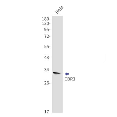 Western Blot: CBR3 Antibody (S06-7B3) [NBP3-19596]