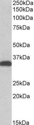 Western Blot: CBR3 Antibody [NB300-858]