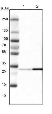 Western Blot: CBR3 Antibody [NBP1-87065]