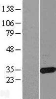 Western Blot: CBR3 Overexpression Lysate [NBL1-08742]