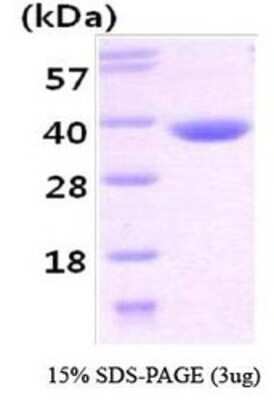 SDS-PAGE: Recombinant Human CBR3 His Protein [NBC1-28781]