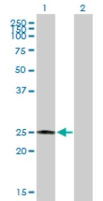 Western Blot: CBR4 Antibody [H00084869-B01P]