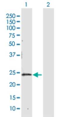 Western Blot: CBR4 Antibody [H00084869-D01P]