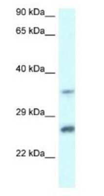 Western Blot: CBR4 Antibody [NBP1-79859]