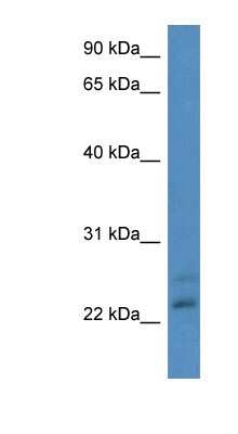 Western Blot: CBR4 Antibody [NBP1-79860]