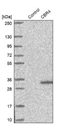 Western Blot: CBR4 Antibody [NBP1-82235]