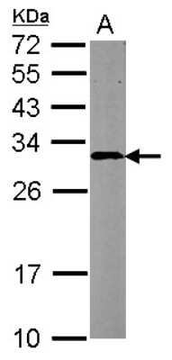 Western Blot: CBR4 Antibody [NBP2-15734]