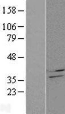 Western Blot: CBR4 Overexpression Lysate [NBP2-05968]