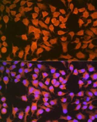 Immunocytochemistry/ Immunofluorescence: CBS Antibody (1R2E9) [NBP3-15413]