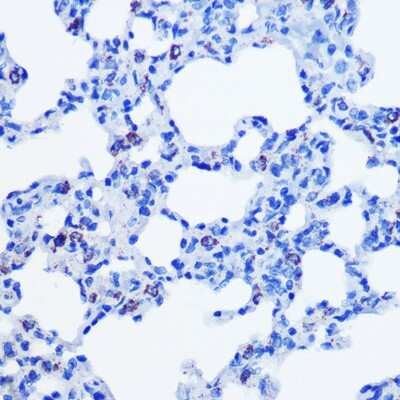 Immunohistochemistry-Paraffin: CBS Antibody (1R2E9) [NBP3-15413]