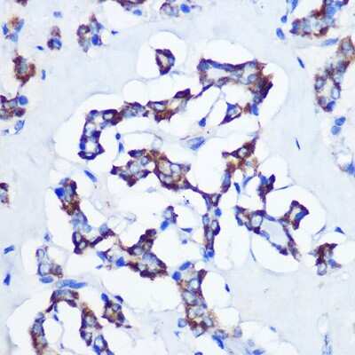 Immunohistochemistry-Paraffin: CBS Antibody (1R2E9) [NBP3-15413]