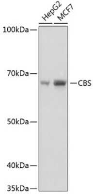 Western Blot: CBS Antibody (1R2E9) [NBP3-15413]