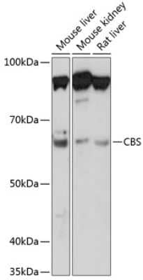 Western Blot: CBS Antibody (1R2E9) [NBP3-15413]