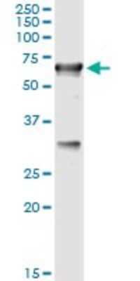 Immunoprecipitation: CBS Antibody (3D10) [H00000875-M02]