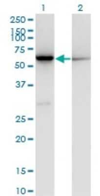 Western Blot: CBS Antibody (3D10) [H00000875-M02]