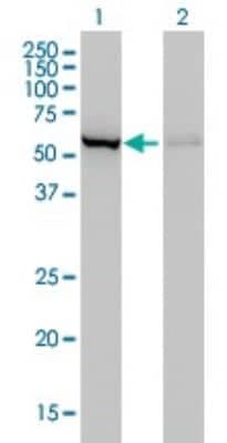 Western Blot: CBS Antibody (3E1) [H00000875-M01]