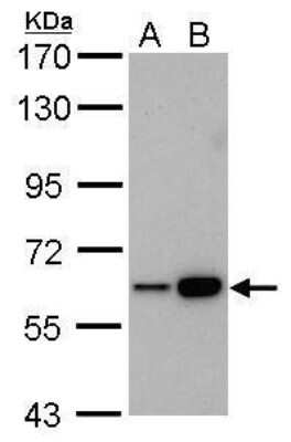 Western Blot: CBS Antibody (519) [NBP2-43604]