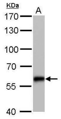 Western Blot: CBS Antibody (519) [NBP2-43604]
