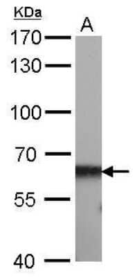 Western Blot: CBS Antibody (519) [NBP2-43604]