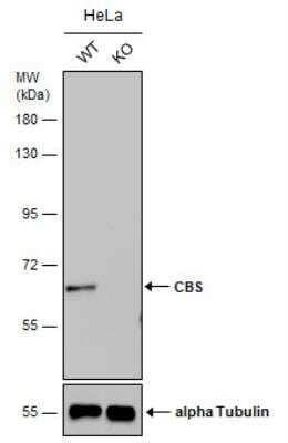 Knockout Validated: CBS Antibody (519) [NBP2-43604]